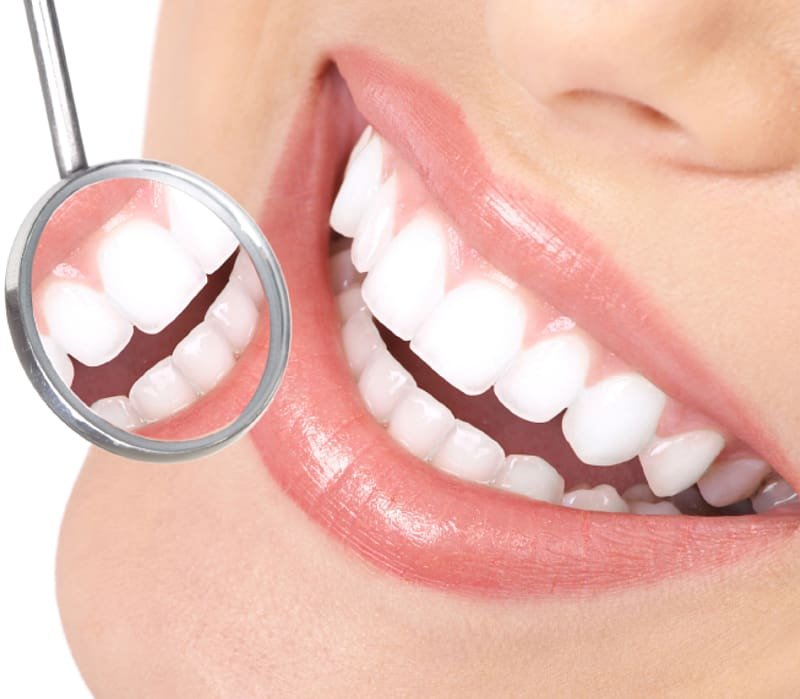 Igiene dentale